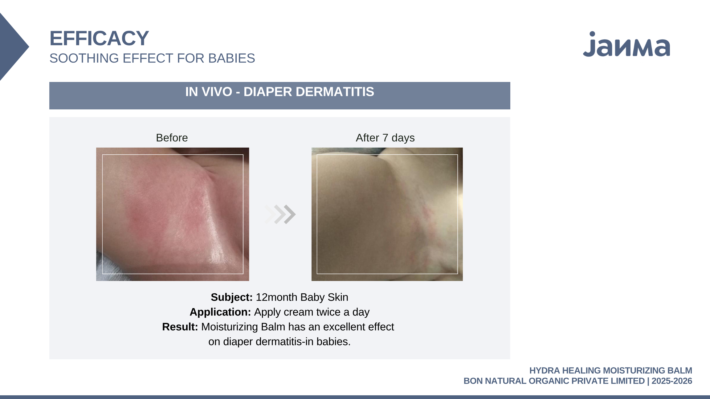Diaper-area redness · 12-month-old · balm applied twice daily · 7 days.