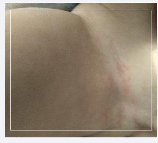Calmer skin, after 7 days