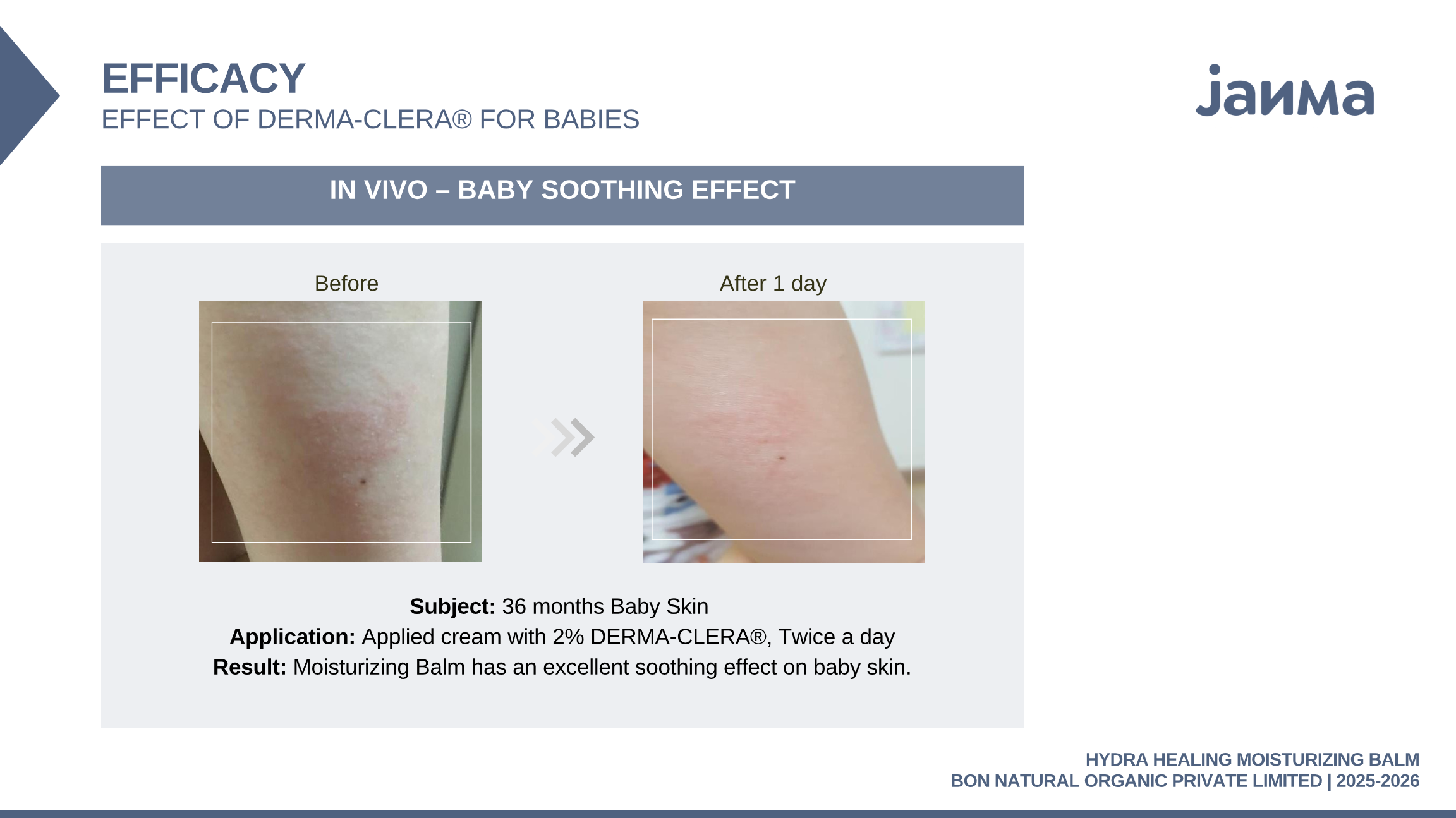 Soothing effect · 36-month-old · balm with 2% DERMA-CLERA® · 1 day.